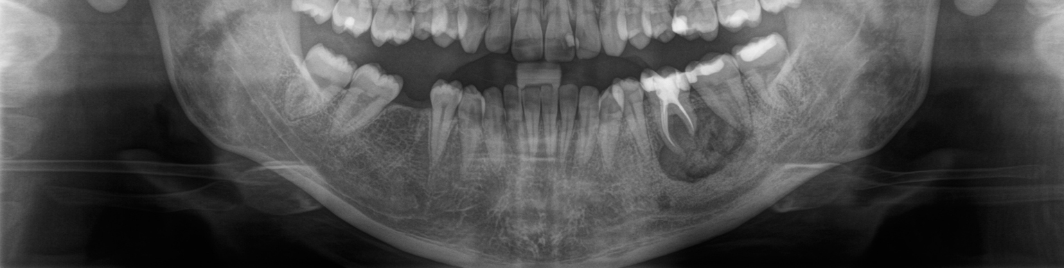 Oralpathologie des Kiefers